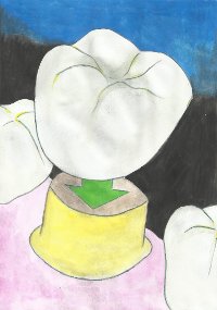coroana2